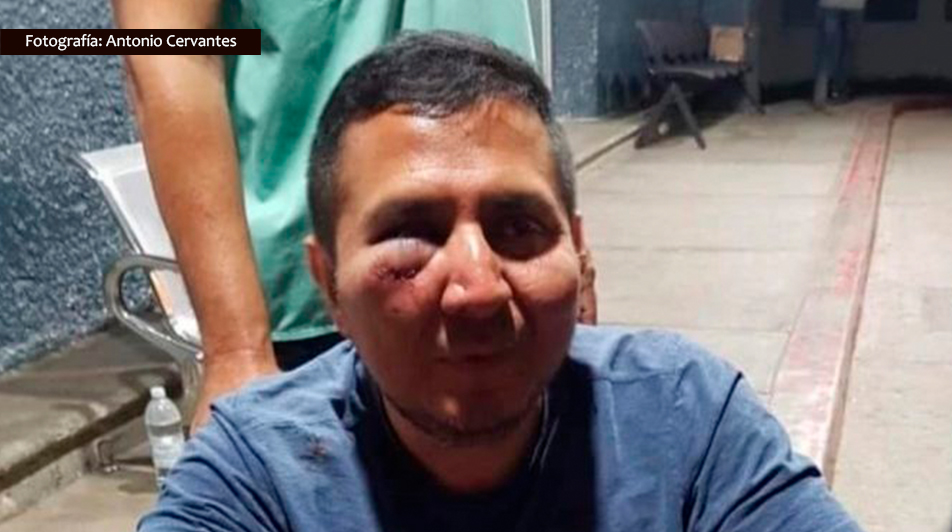 ARTICLE 19 denuncia agresiones contra periodista de Los Cabos