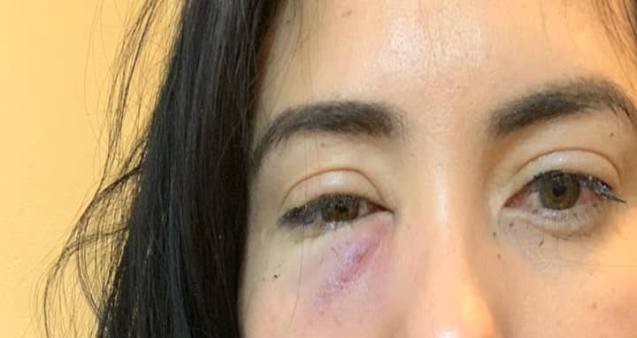 En La Paz, mujer sufre violencia de género y denuncia a su agresor